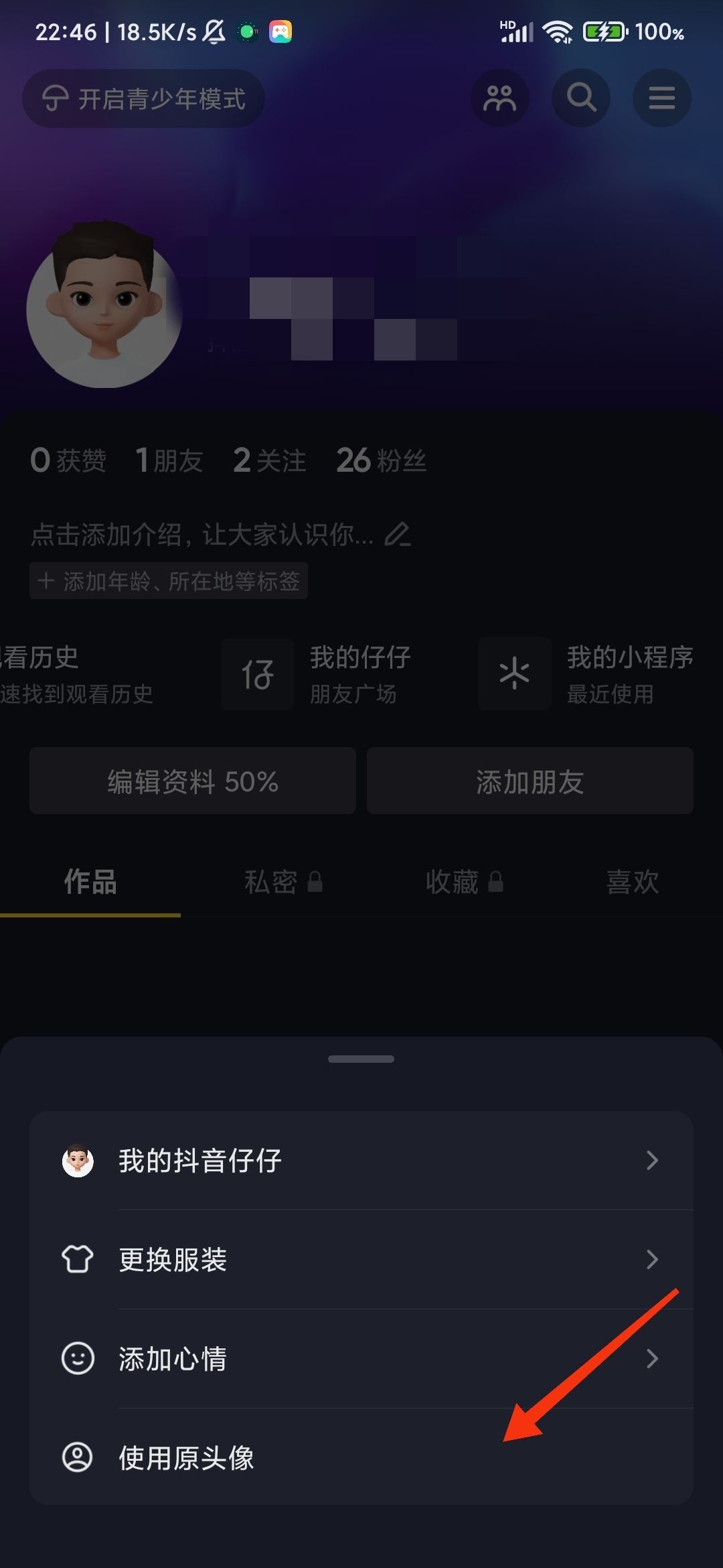 抖音仔仔怎么關(guān)閉？