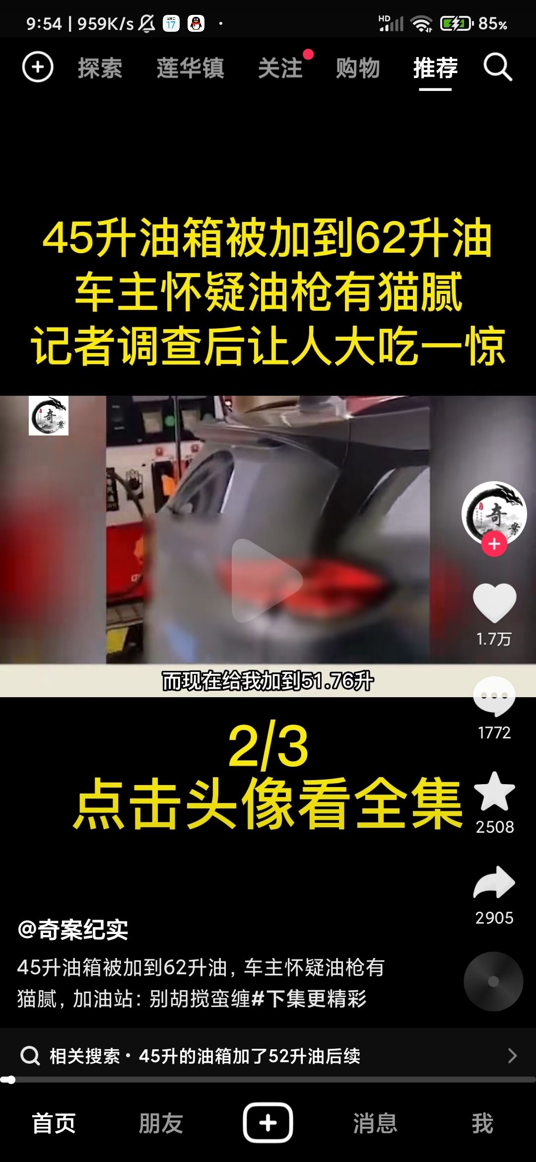 抖音頭像上快進(jìn)按鈕怎么設(shè)置？