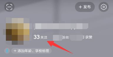 頭條如何添加抖音好友？