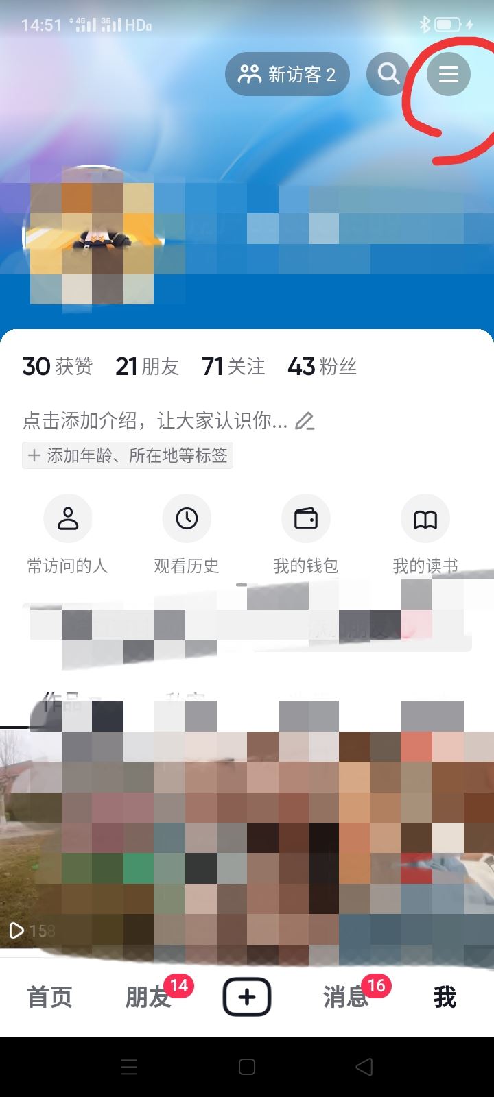 抖音?？吹娜嗽趺搓P掉關注提示？